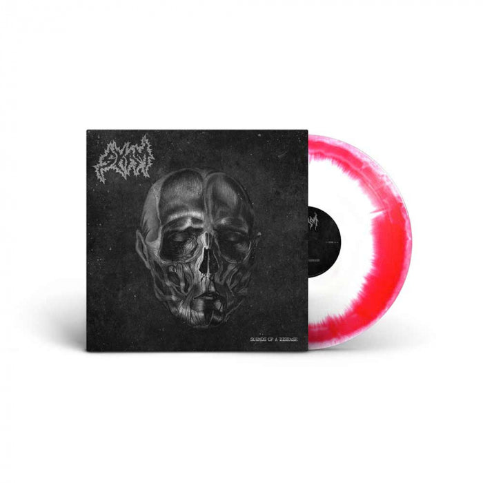 SKAM - Sound Of A Disease / Limited Edition Red White Inkspot Vinyl LP